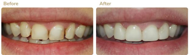 Before and after 3